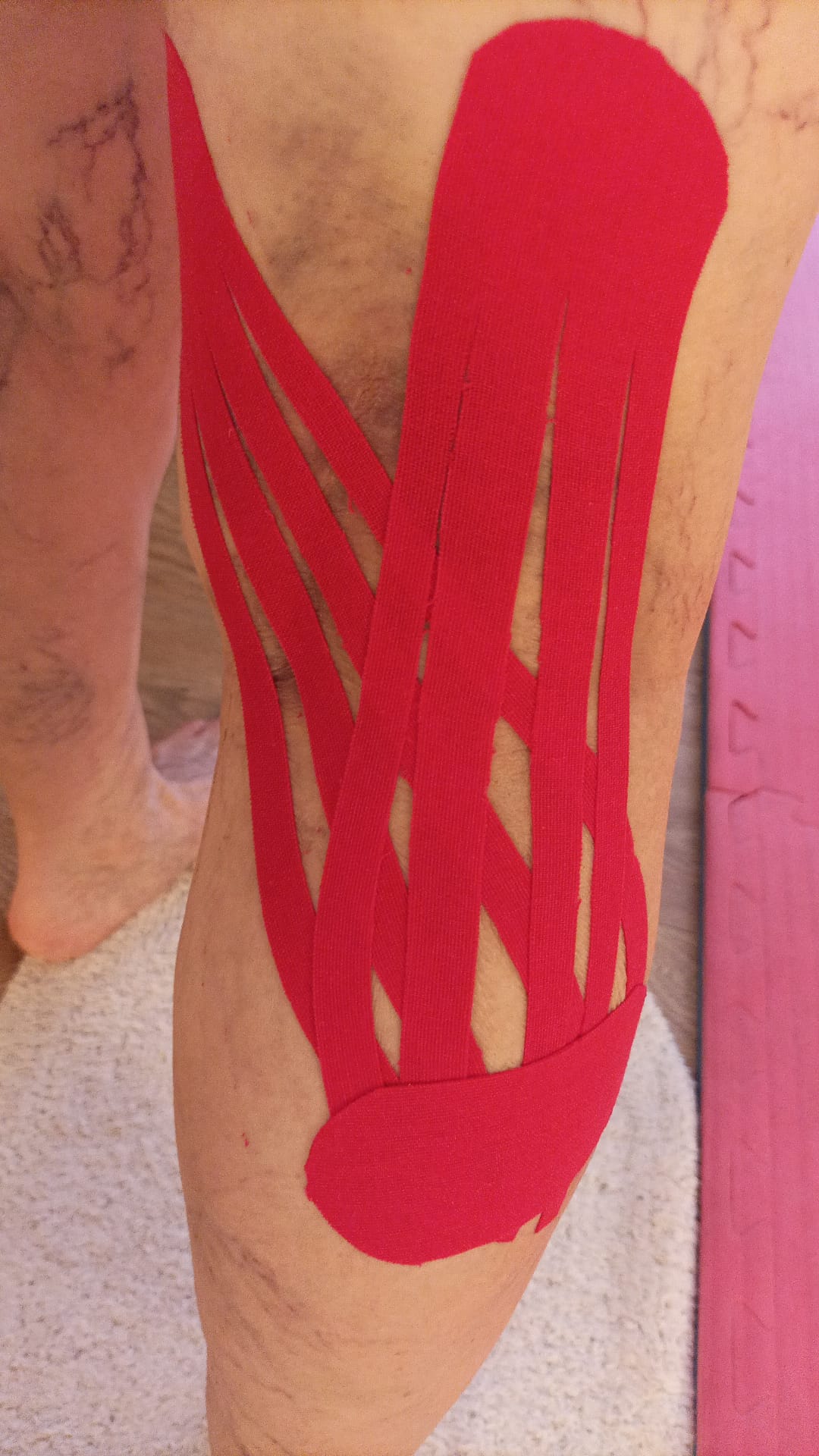 Taping Elastico